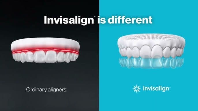 Invisalign vs Other Clear Aligners | Cost, Benefits & Comparison