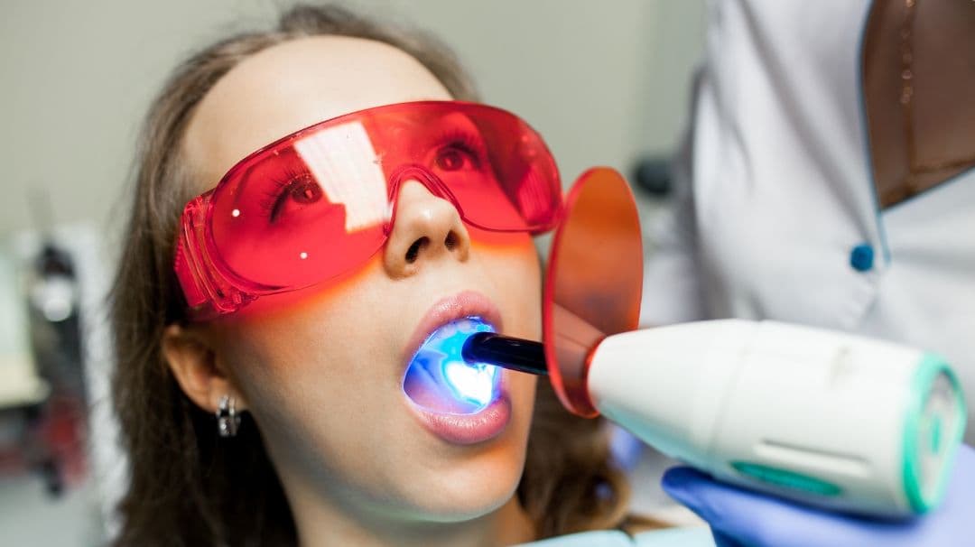 Laser Dental Treatment in Patna– Advanced Care at Magadh Oro Dental