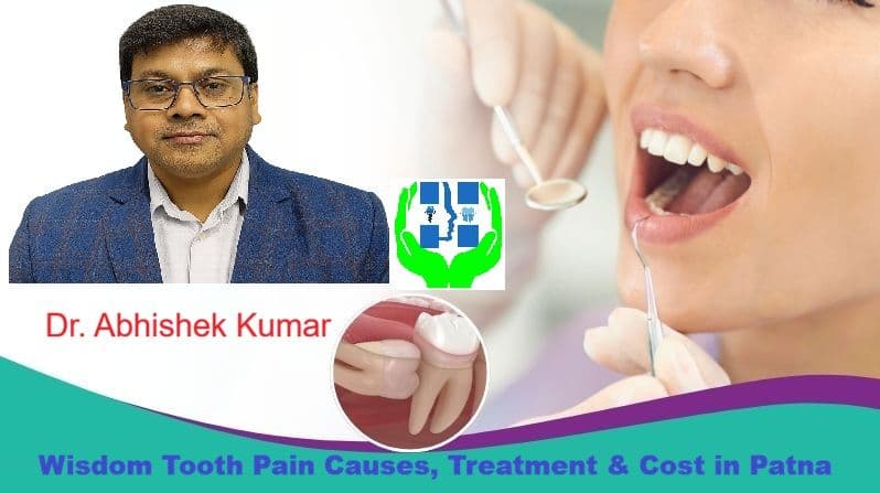 Wisdom Tooth Pain Causes, Treatment & Cost in Patna | Dr. Abhishek Kumar