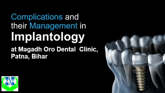 Dental Implant Complications, Management & Prevention | Best Dental Implant Clinic in Patna