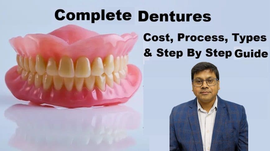 Complete Dentures in Patna – Cost, Process, Types & Step By Step Guide