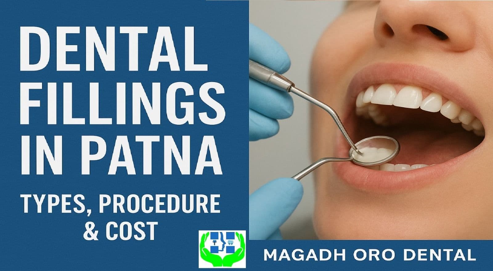 Dental Fillings in Patna | Types, Procedure & Cost at Magadh Oro Dental