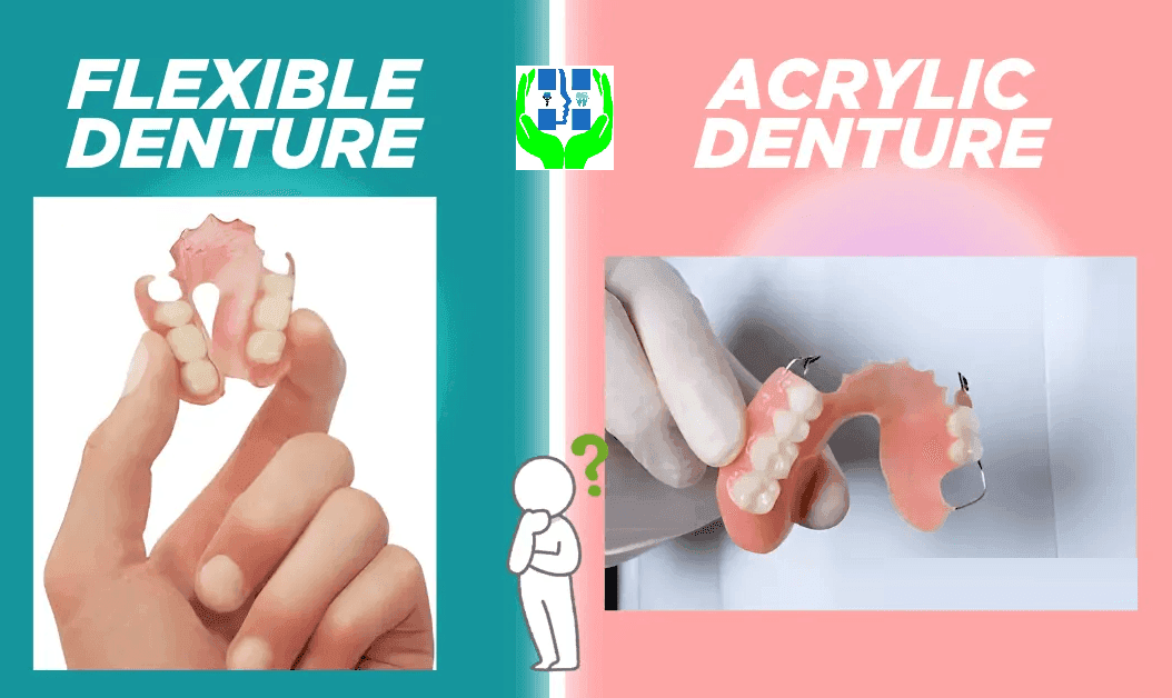 Flexible Partial Dentures : Benefits and Cost in Patna | Dr. Abhishek Kumar