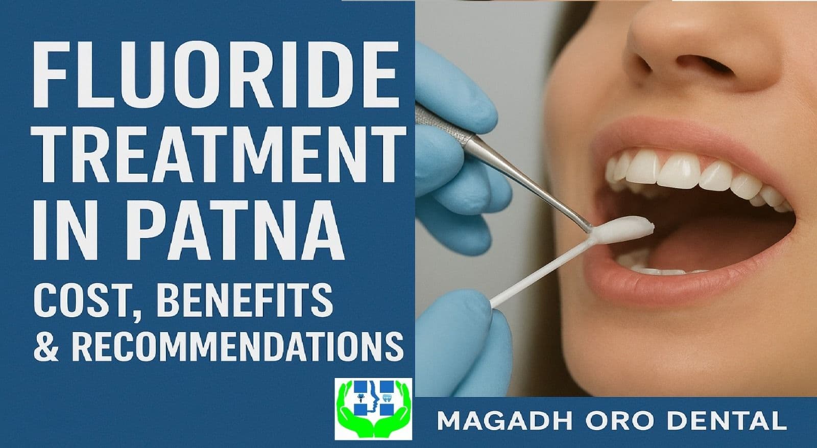 Fluoride Treatment: Recommendations, Benefits, Side Effects, and Cost in Patna, Bihar